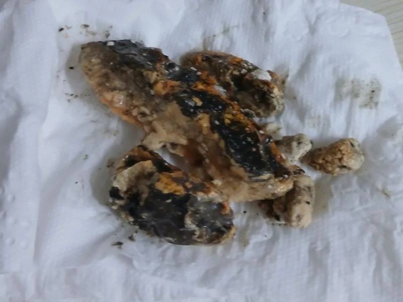 삼송 변기 이물질 제거 사례 5